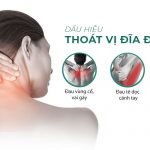 dau-hieu-thoat-vi-dia-dem-co