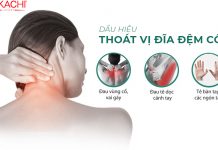 Khám Phá Kịch Bản Tập Luyện Thoát Vị Đĩa Đệm Cổ An Toàn Và Hiệu Quả