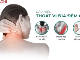 Khám Phá Kịch Bản Tập Luyện Thoát Vị Đĩa Đệm Cổ An Toàn Và Hiệu Quả